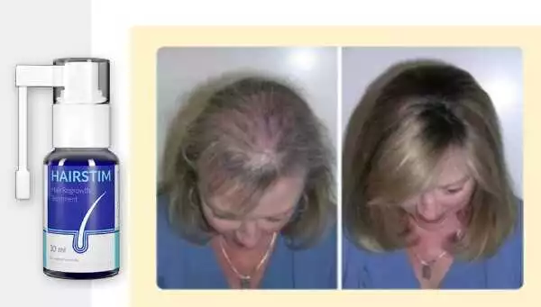 Hairstim – Tratament pentru păr la Farmacia Fecioara: cum să îți îmbunătățești sănătatea părului cu Hairstim
