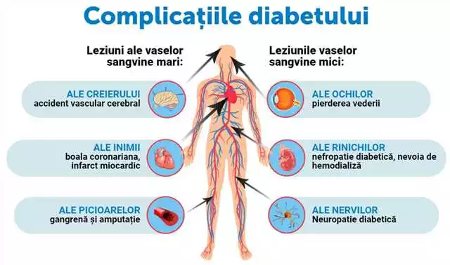 Insunol în Constanța: tratamentul eficient pentru diabet de la specialiștii noștri