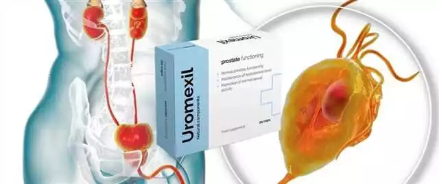 Uromexil cumpără în Oradea: cel mai bun remediu pentru problemele tractului urinar