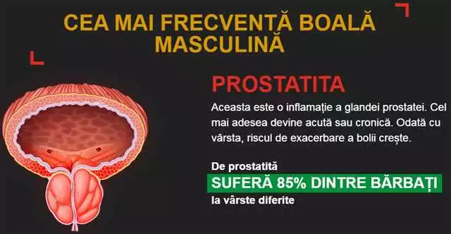 Reducerea Inflamației Prostatei